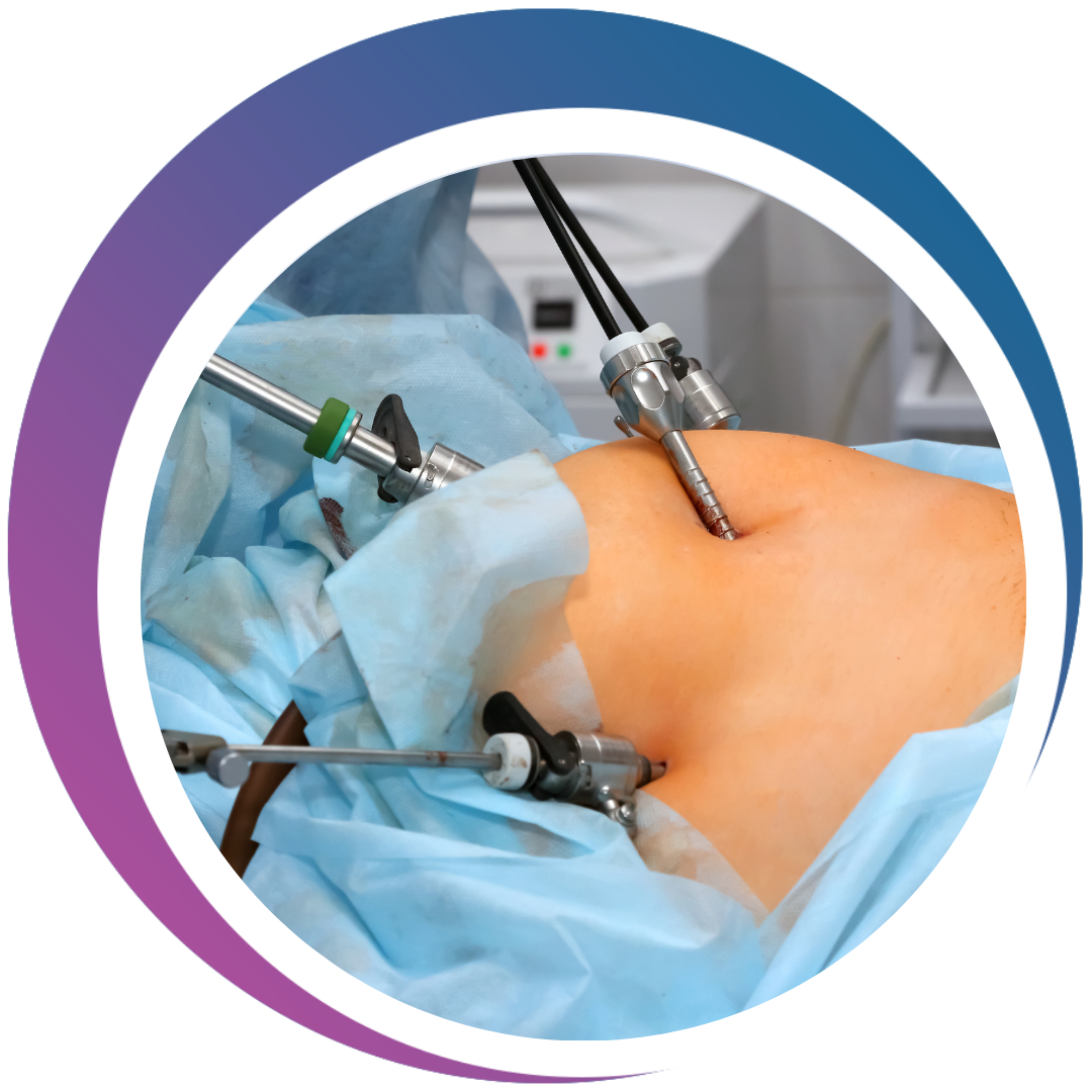 Laparoscopic Hysterectomy & Ovarian Surgeries